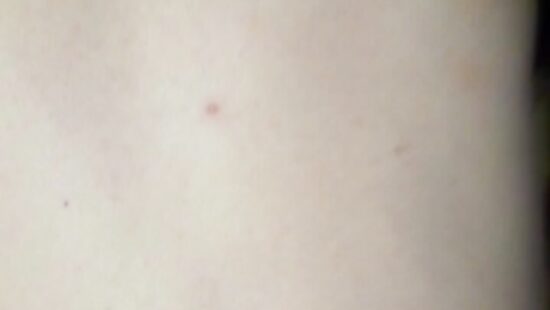 поставил раком